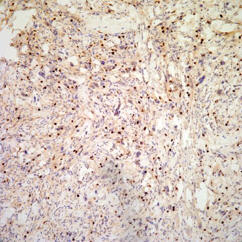 File:Myogenin.mast cells.100x.jpg