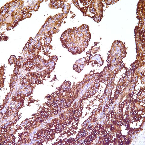 File:Thyroglobulin.jpg