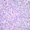 Thumbnail for version as of 19:03, February 24, 2010