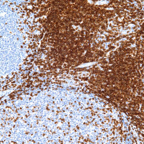 File:CD3.tonsil.1.jpg