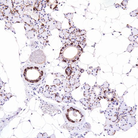 File:CK5-6.parotid.2.jpg