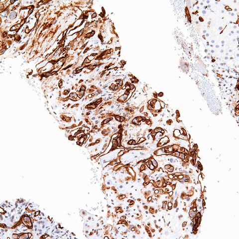 File:CD34.EHE.6.jpg