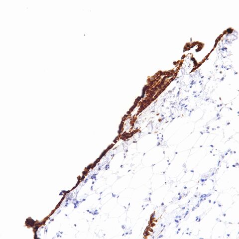 File:Desmin.mesothelium..jpg