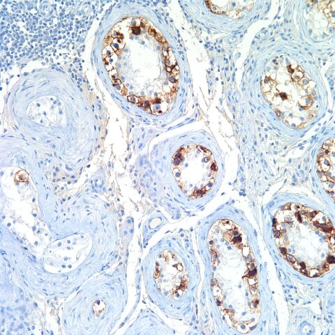 File:PLAP.intratubular germ cell neoplasia.1.jpg