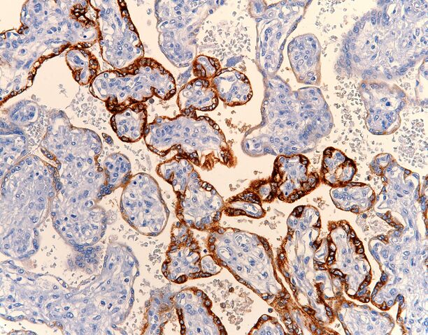 File:HCG.placenta.200x.jpg