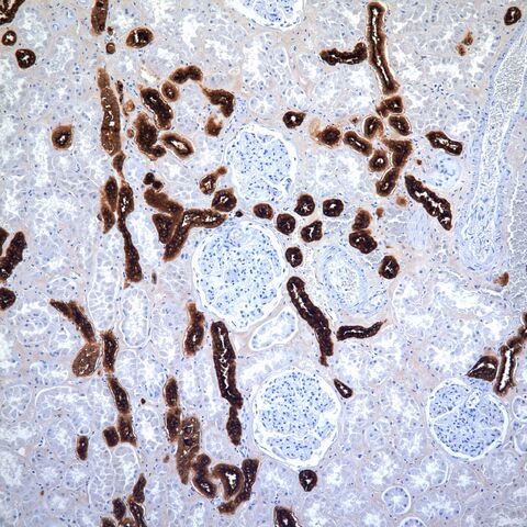 File:EMA.kidney.jpg