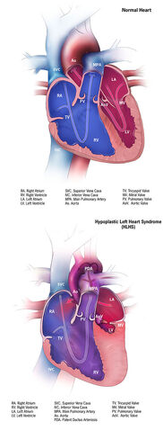 File:Hypo.jpg