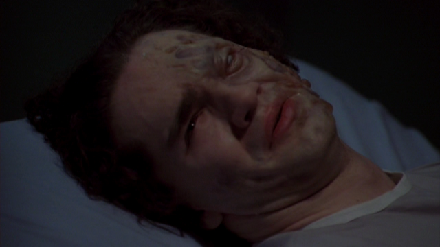 File:Necrosis Victim.png