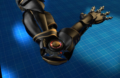 Prosthetic arm