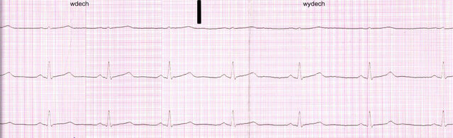 File:EKG.jpg