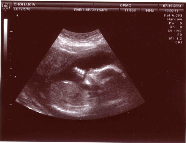 File:Baby in ultrasound.jpg