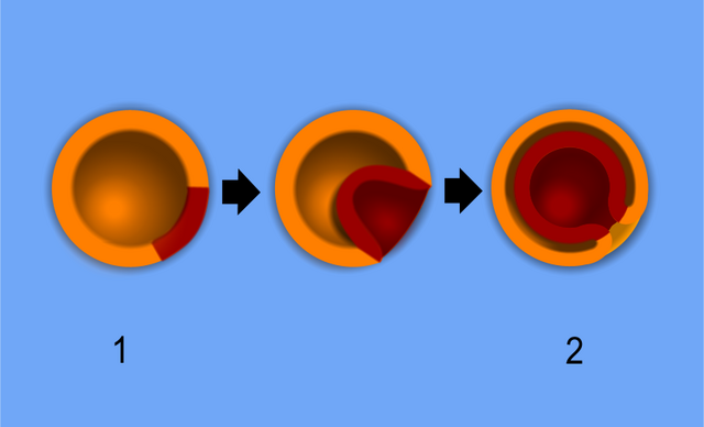 File:Gastrulation.png