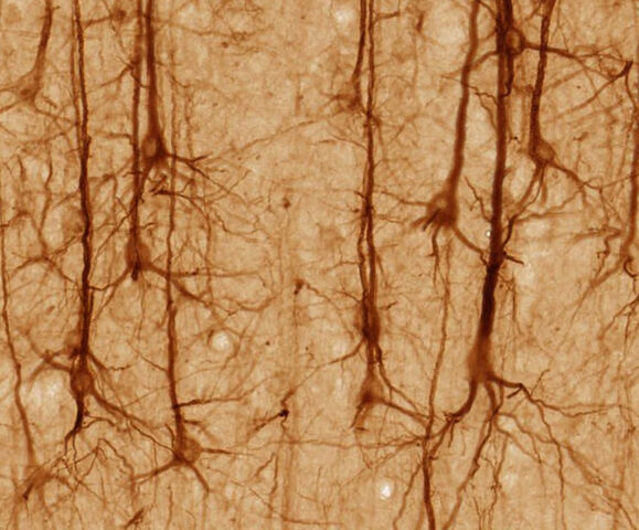 File:Smi32neuron.jpg
