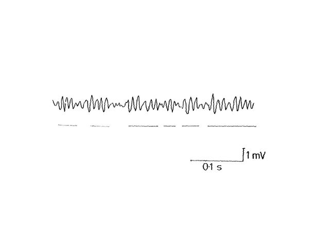 File:OMT Trace.jpg