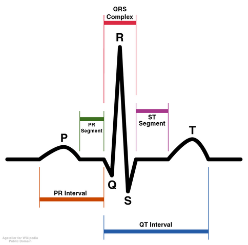 File:SinusRhythmLabels.png