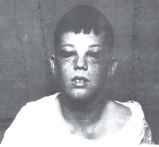 File:My lobotomy-howard after full.jpg
