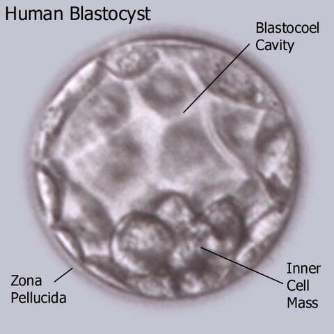 File:Blastocyst.jpg