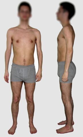File:Male borderline underweight.jpg
