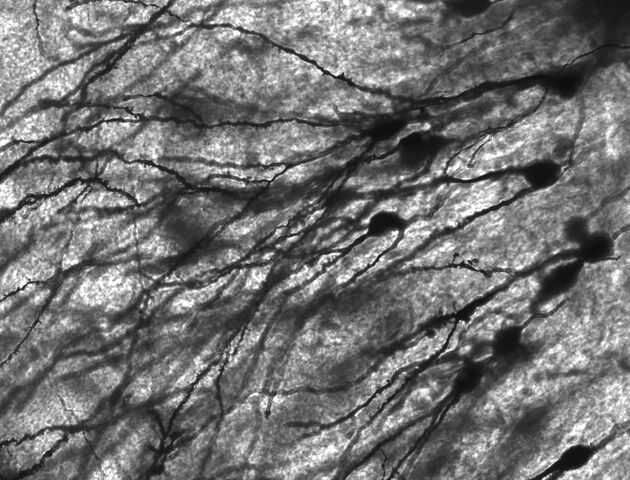 File:Gyrus Dentatus 40x.jpg