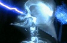 Dvbones1.jpg