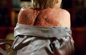 4x11 - Elizabeth North Scars