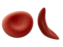 Deseases-Anemia-01-goog.jpg