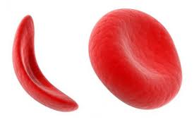 Red-Blood-Cell-Anemia-01-goog.jpg