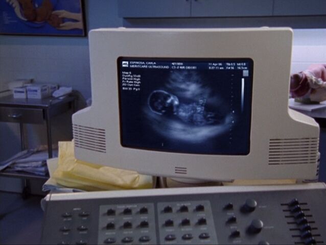 File:5x18-Gay Baby Turk.jpg
