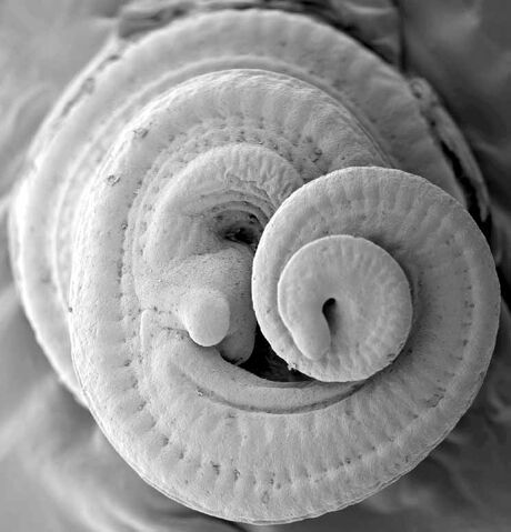 File:Embryo.jpg