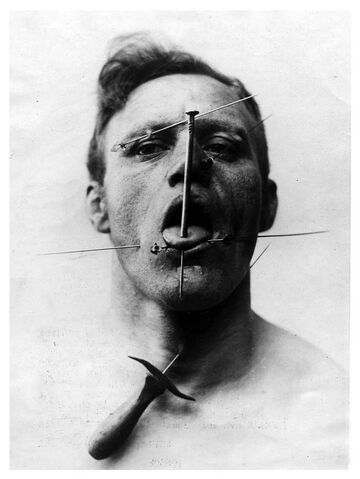 File:Human Pin.jpg