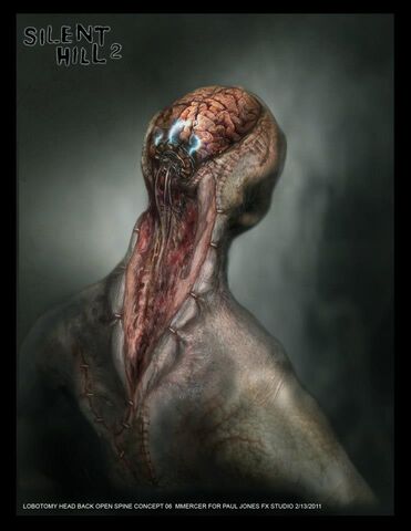 File:Lobotomy back ca.jpg