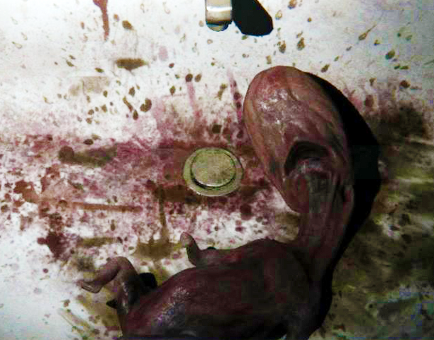 File:Fetus.png