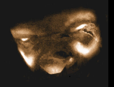 Face