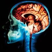 Brain
