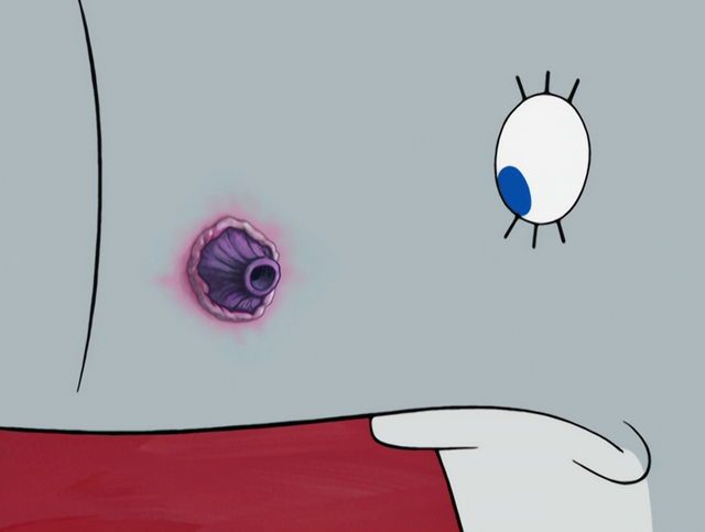 File:Pearlwithbarnaclepimple.png