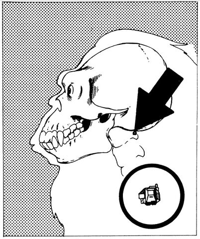 File:Anti-Shock Implant.jpg