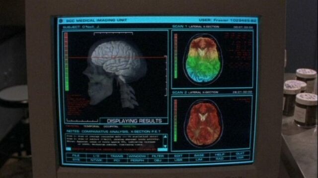 File:Brain.jpg