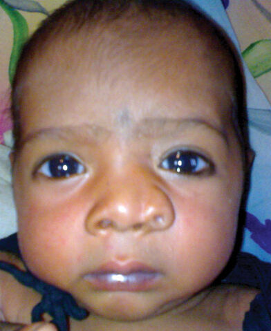 File:Third Nostril.jpg
