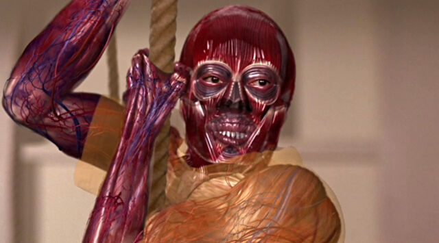 File:Smallville xray 04.jpg