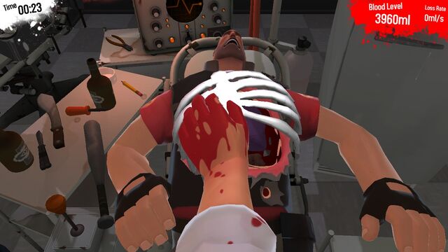 File:Complete Rib Cage.jpg