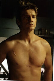 Dorn body