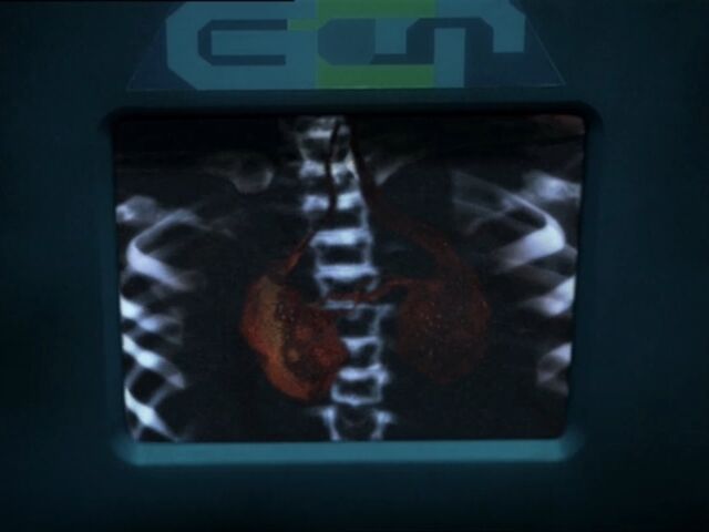 File:Ninth Doctor's Binary Vascular System.jpg