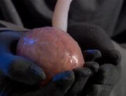 Ood hindbrain