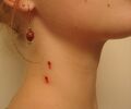 Thumbnail for version as of 06:03, February 18, 2011