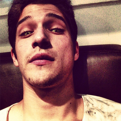File:Teen Wolf Wikia Season 3 Behind the Scenes Tyler Posey Werewolf Eyes.png