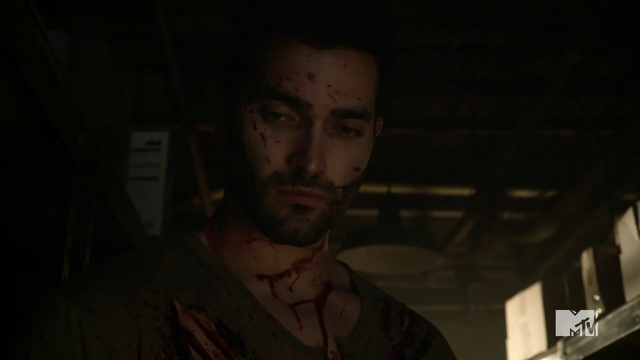 File:Teen Wolf Season 3 Episode 3 Fireflies Tyler Hoechlin Derek Hale covered in blood.png
