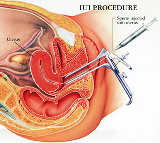 File:IUI001.jpg