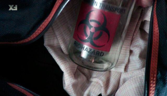 File:--Tularemia-- sample.jpg