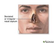 Septum