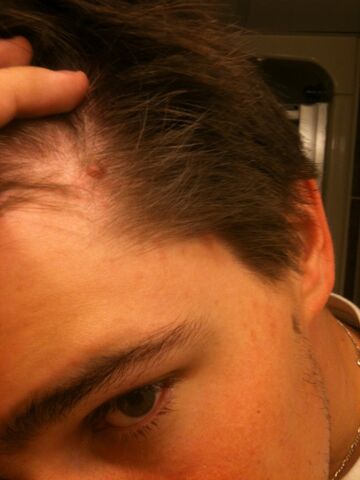 File:Trevor's Mole.jpg